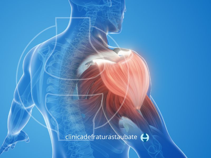 Imagem em 3D de um homem, com destaque em uma para avermelhada, mostrando que ele sente dor no ombro.