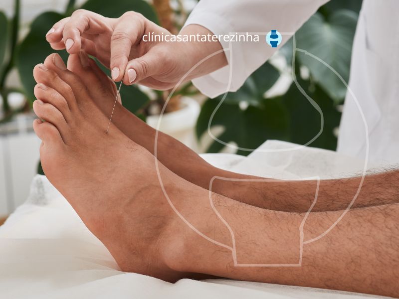 Médica fazendo acupuntura nos pés do paciente.