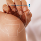 Acupuntura traz benefícios sem causar efeito colateral.